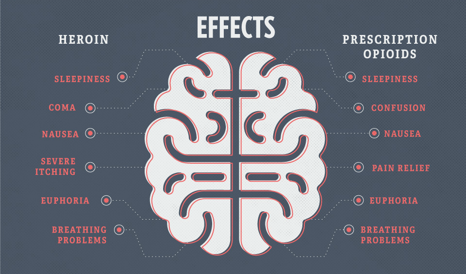 Medical illustration showing how opiates affect the brain's neurotransmitters, highlighting areas responsible for pain relief and euphoria.